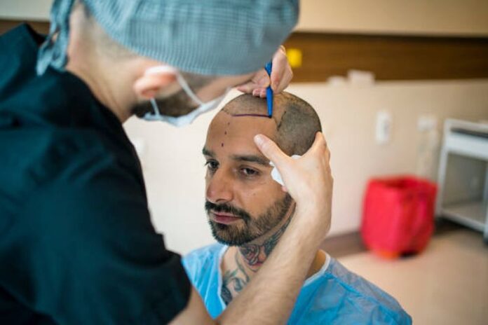 Best Hair Transplant Surgery for men & women