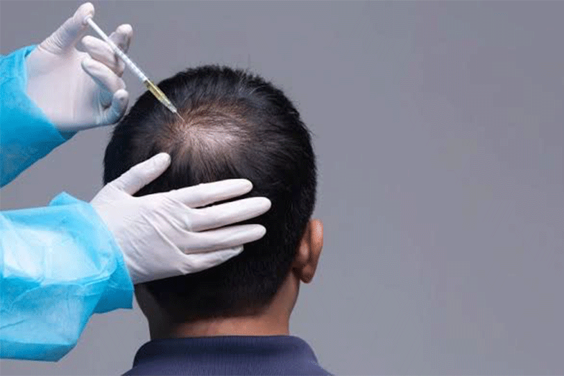 prp hair treatment cost in india