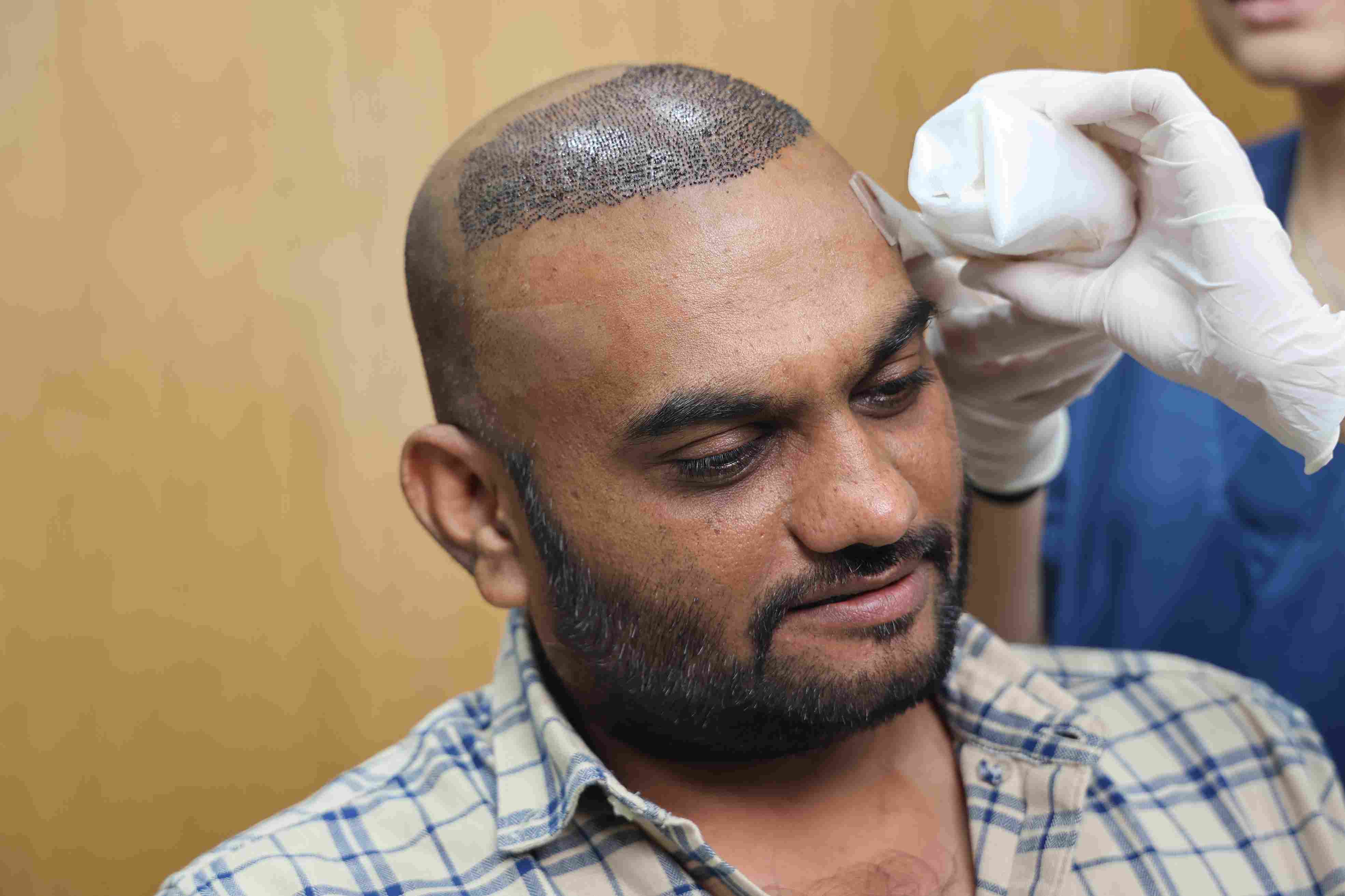 Bandage After Hair Transplant Procedure