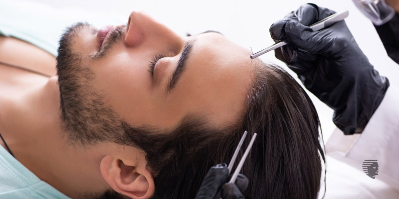 Hair Transplant Correction in surat