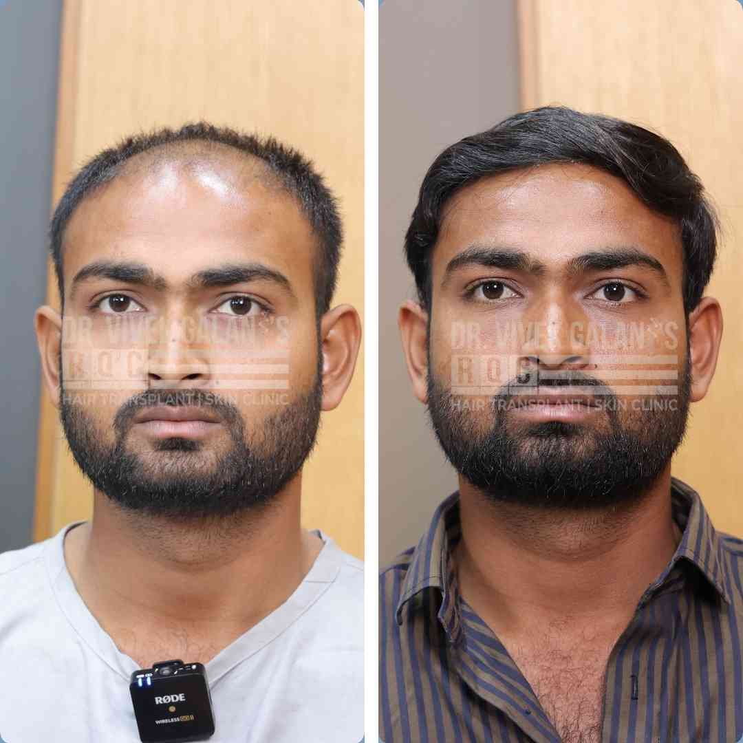 Nawabbhai Deewan After Before