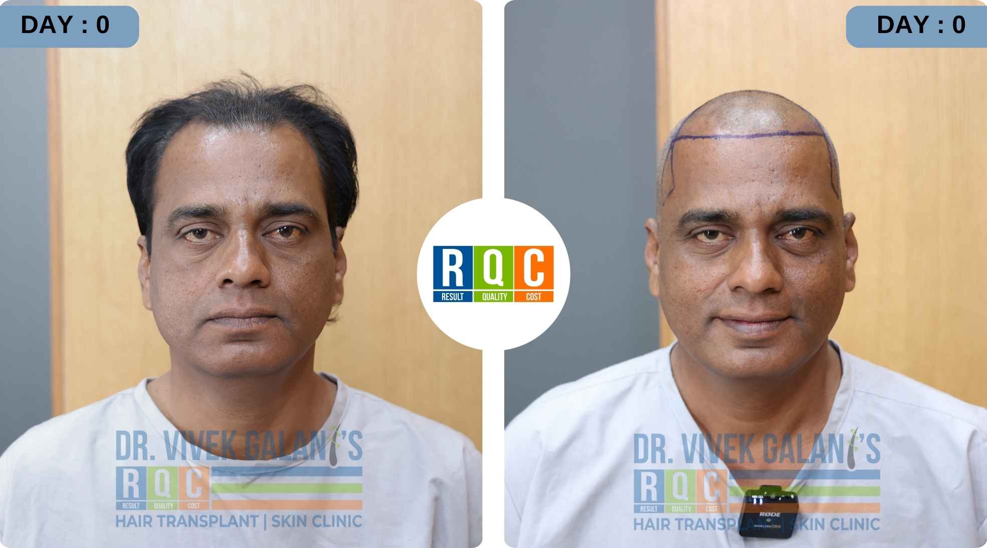 10 Month Result  1 