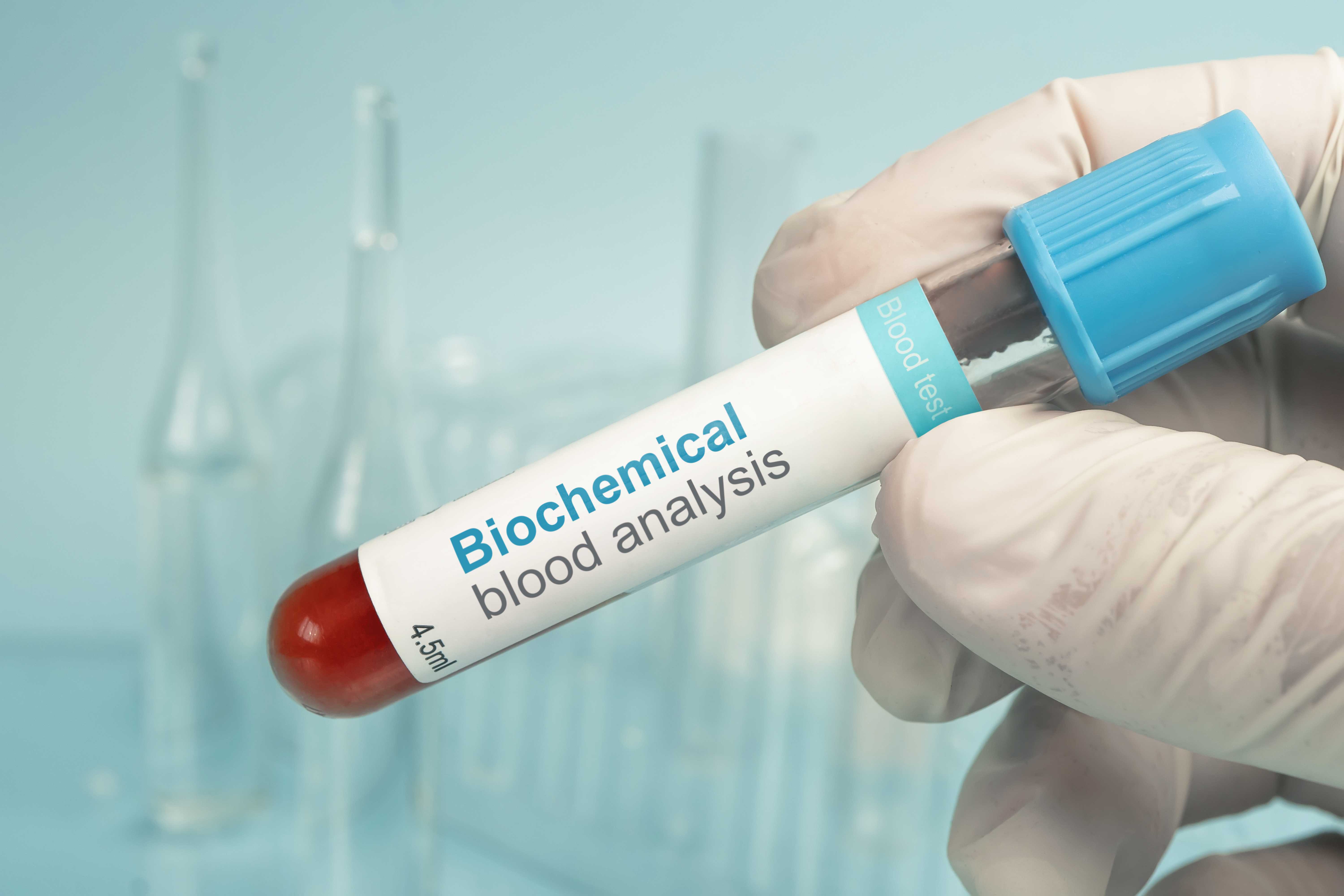 Blood Reports and Analysis